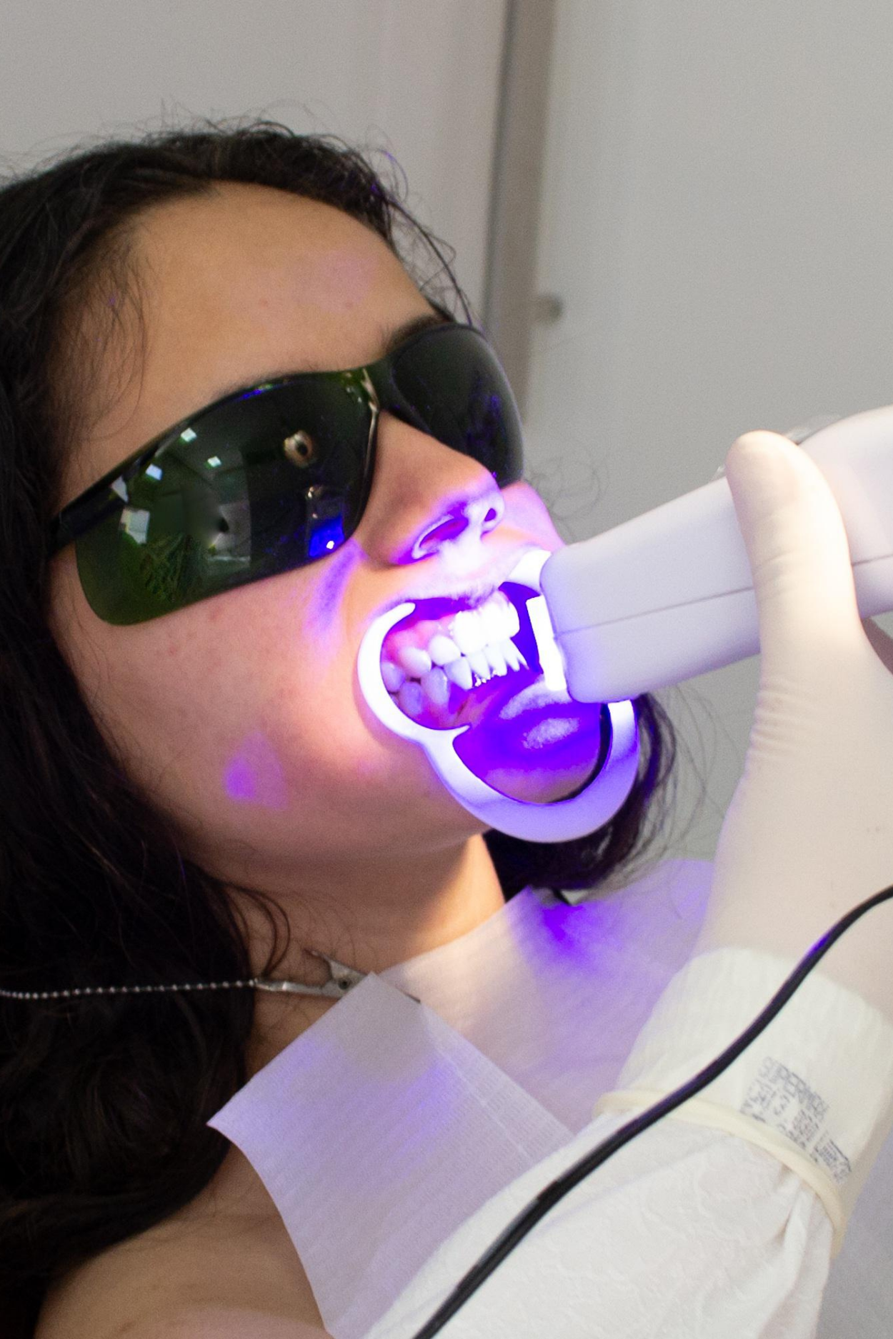 woman teeth whitening